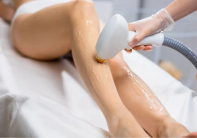 Fotodepilación - Tratamiento estética Callosa d'en Sarrià