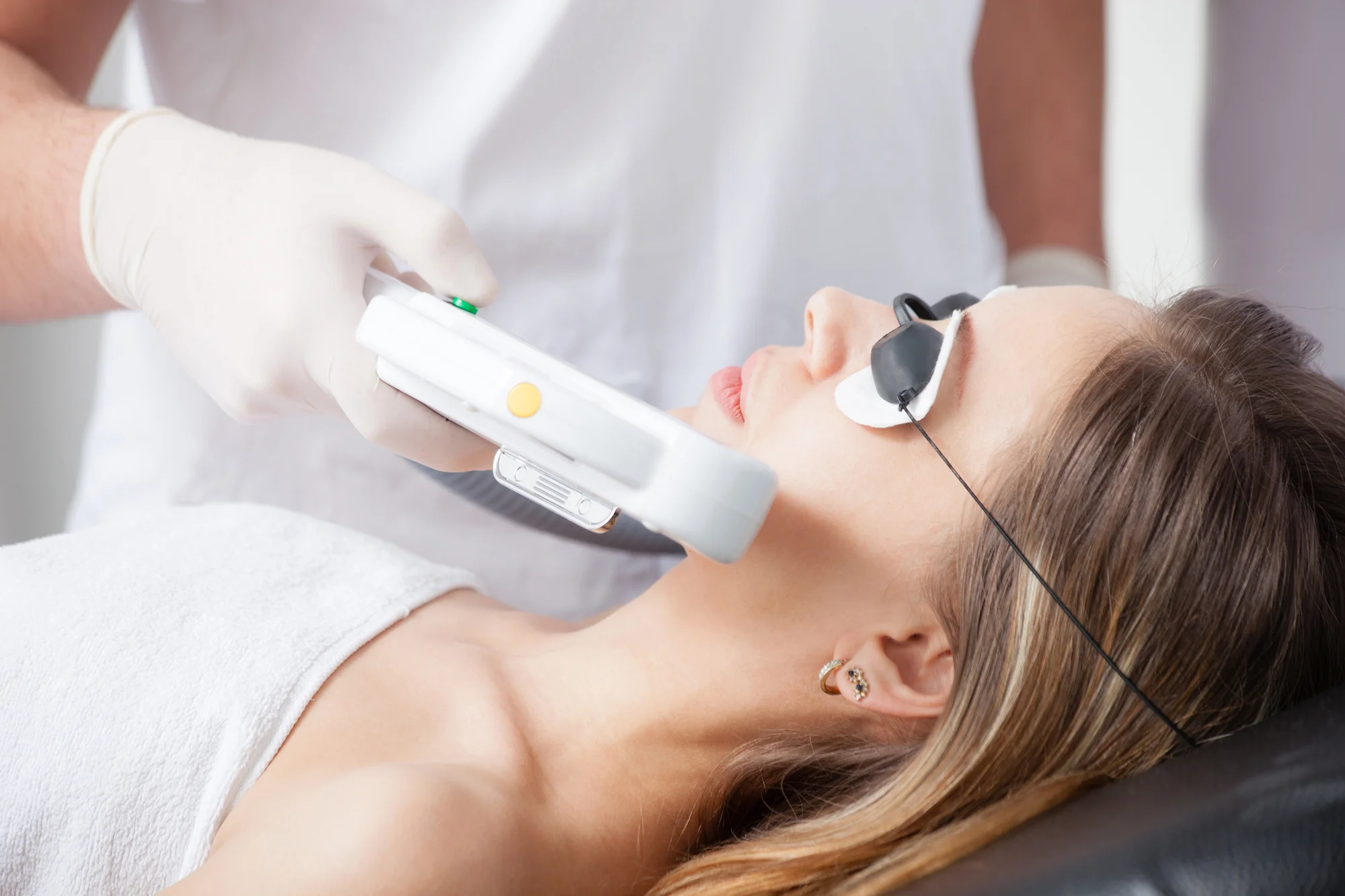Fotorejuvenecimiento - Tratamiento estética Callosa d'en Sarrià