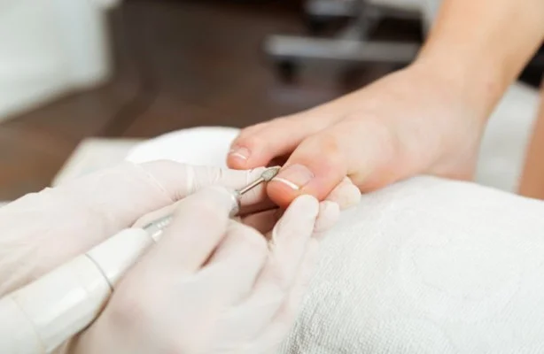 Pedicura - Tratamiento estética Callosa d'en Sarrià